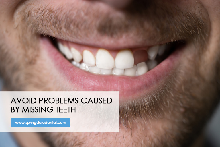 Avoid problems caused by missing teeth