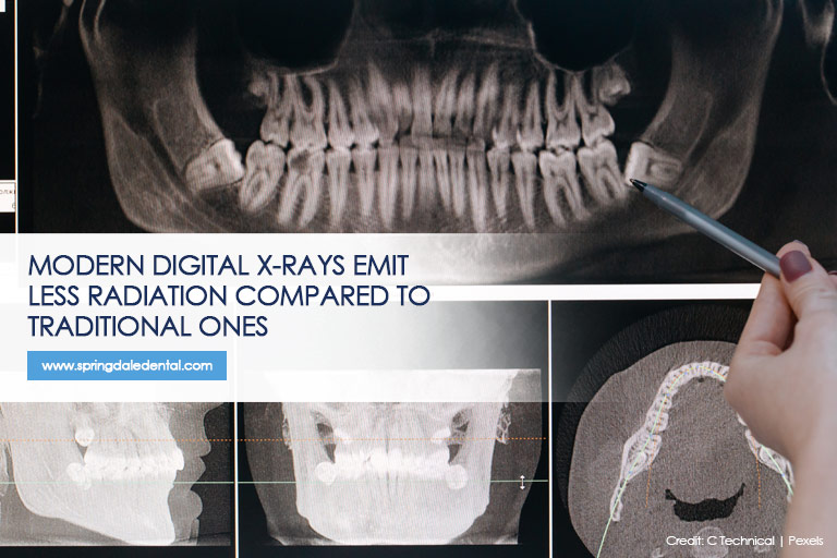 The radiation dose in dental X-rays are negligible