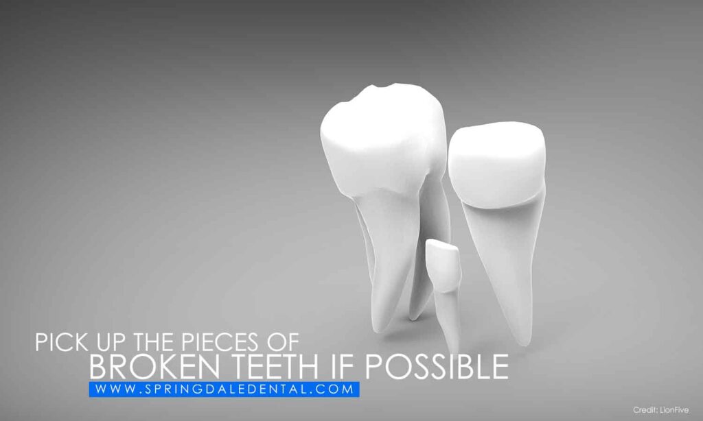 Pick-up-the-pieces-of-broken-teeth-if-possible