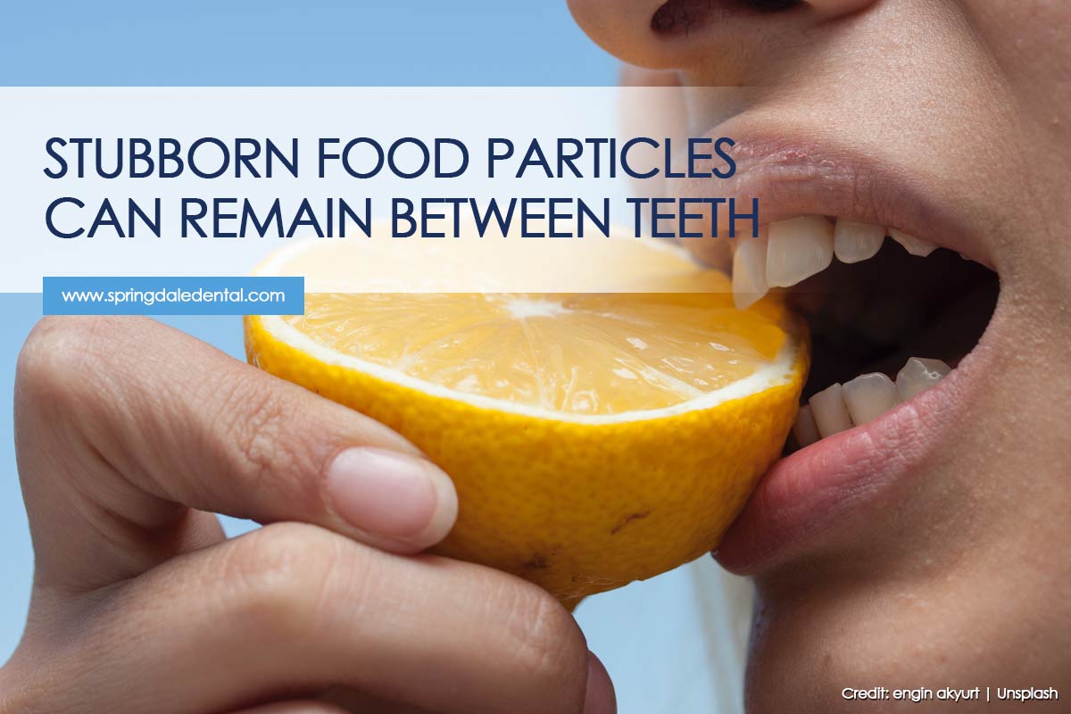 Stubborn food particles can remain between teeth