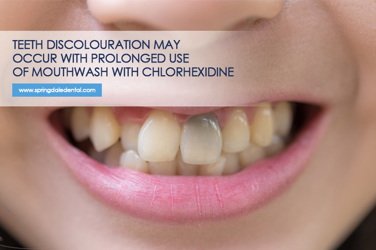 Teeth-discolouration-may-occur-with-prolonged-use-of-mouthwash-with-chlorhexidine