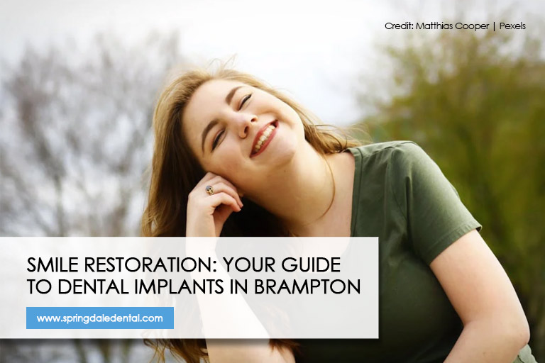 Smile Restoration: Your Guide to Dental Implants in Brampton