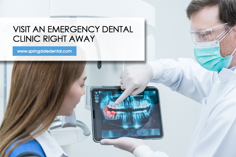 Visit an emergency dental clinic right away