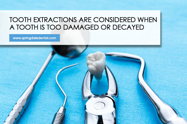 Tooth extractions are considered when a tooth is too damaged or decayed