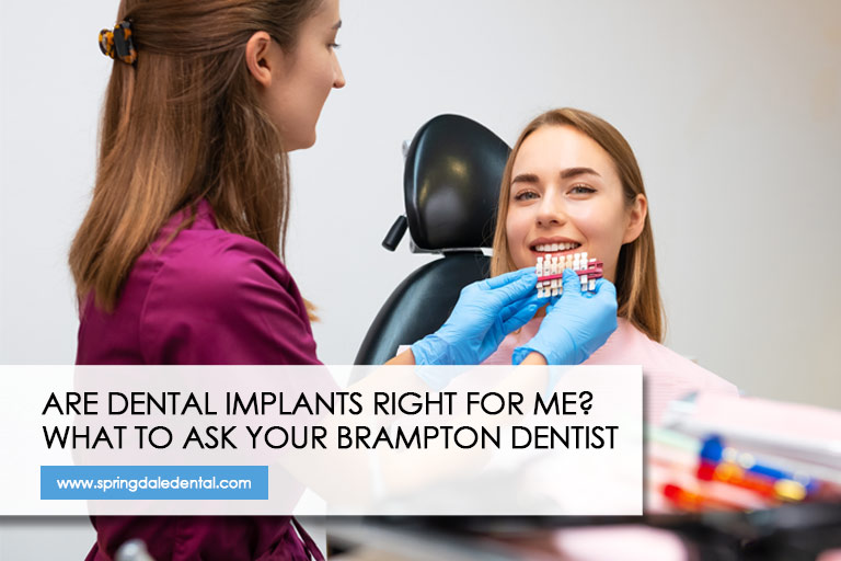 Are Dental Implants Right For Me? What to Ask Your Brampton Dentist