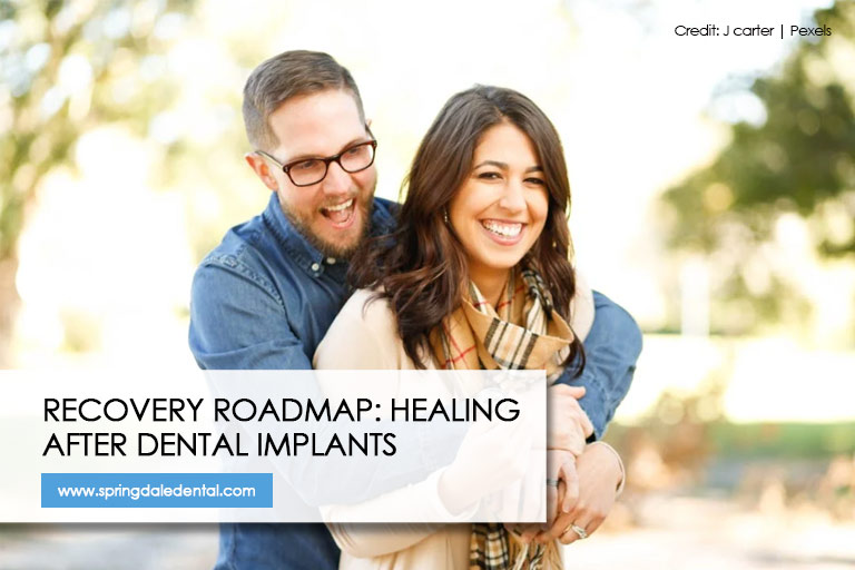 Recovery Roadmap: Healing After Dental Implants