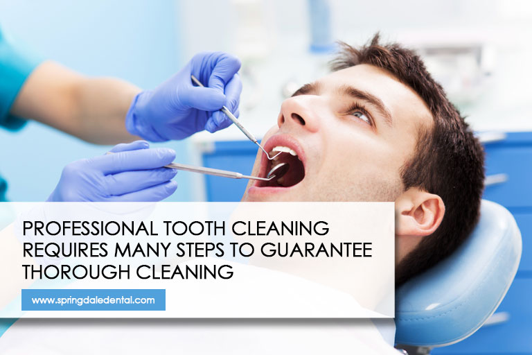 Professional tooth cleaning requires many steps to guarantee thorough cleaning