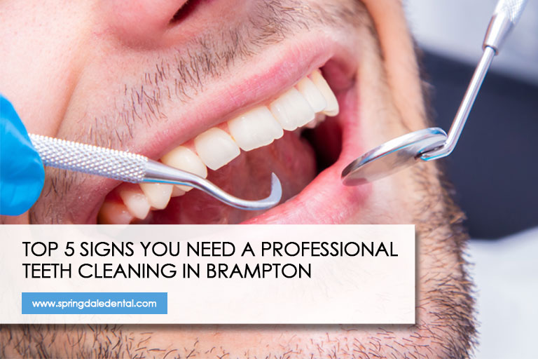 Top 5 Signs You Need a Professional Teeth Cleaning in Brampton