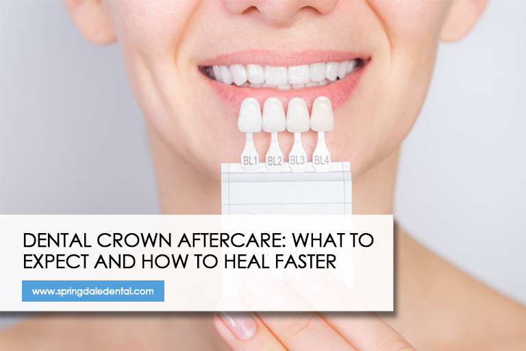 Dental Crown Aftercare: What to Expect and How to Heal Faster