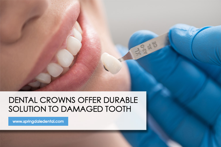 Dental crowns offer durable solution to damaged tooth