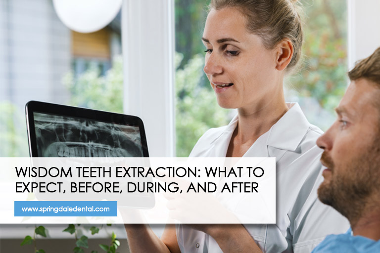 Wisdom Teeth Extraction: What to Expect, Before, During, and After