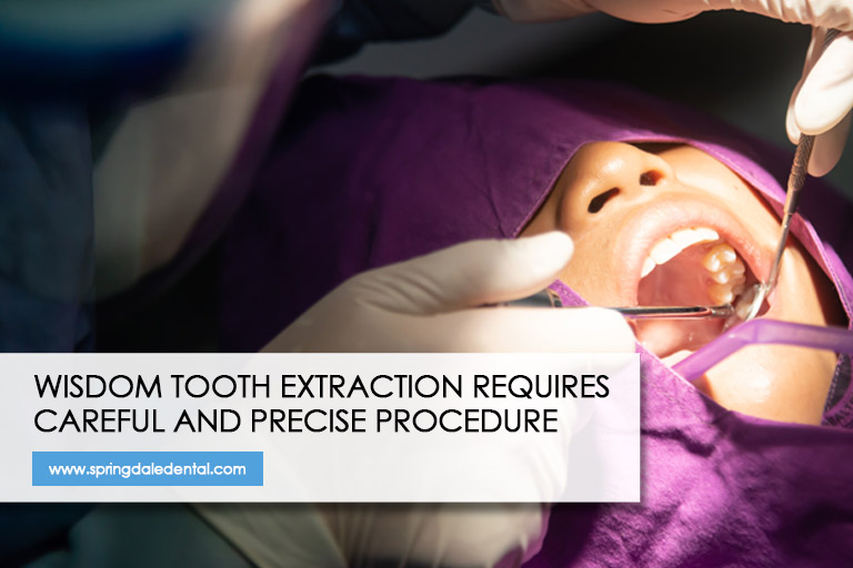 Wisdom tooth extraction requires careful and precise procedure 