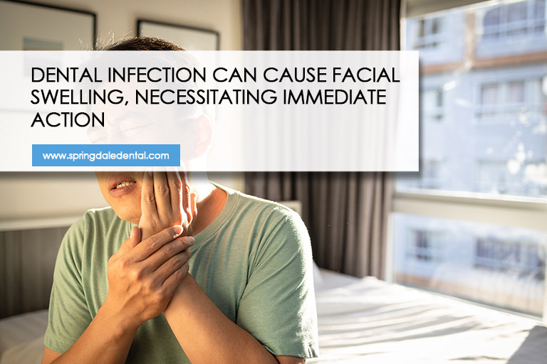 Dental infection can cause facial swelling, necessitating immediate action