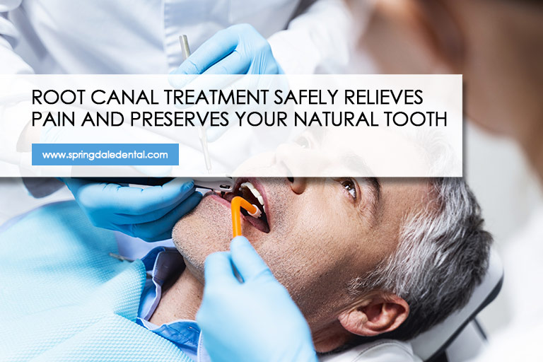 Root canal treatment safely relieves pain and preserves your natural tooth