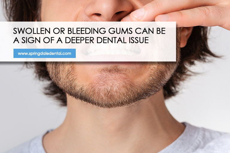 Swollen or bleeding gums can be a sign of a deeper dental issue