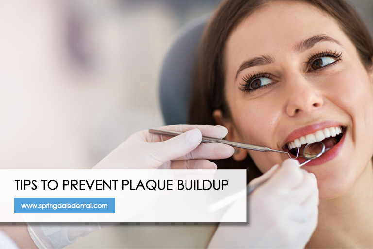 Tips to Prevent Plaque Buildup 