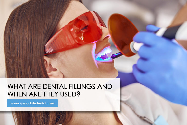 What Are Dental Fillings and When Are They Used?