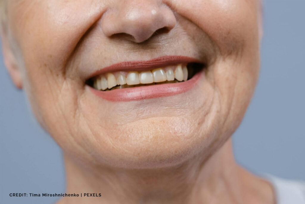 Intrinsic Stains: Deep-Seated Discolouration