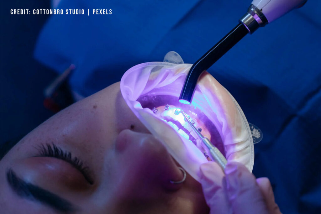 Choosing the Right Cosmetic Dentistry Option