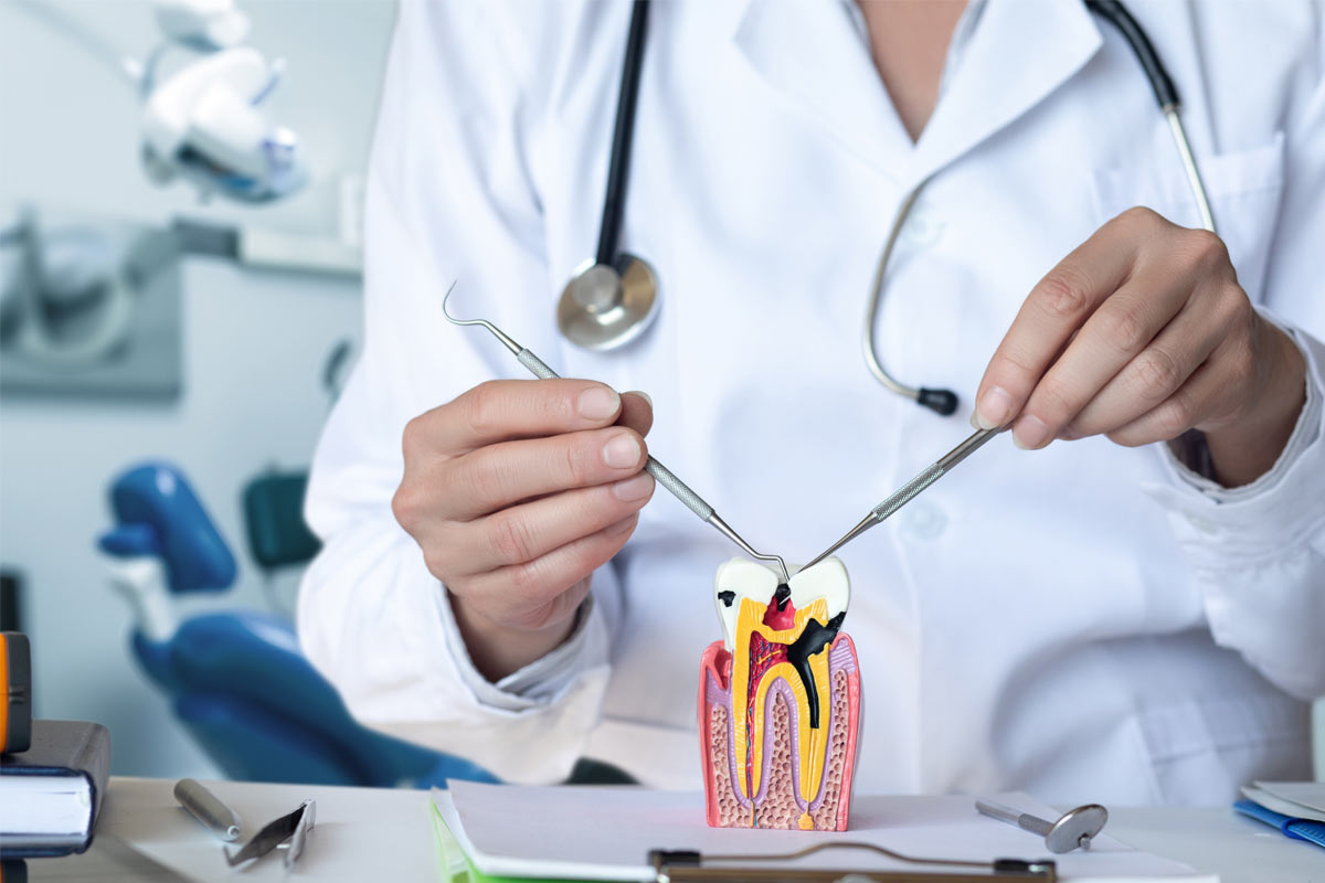 Why Ignoring Tooth Pain Can Lead to a Root Canal