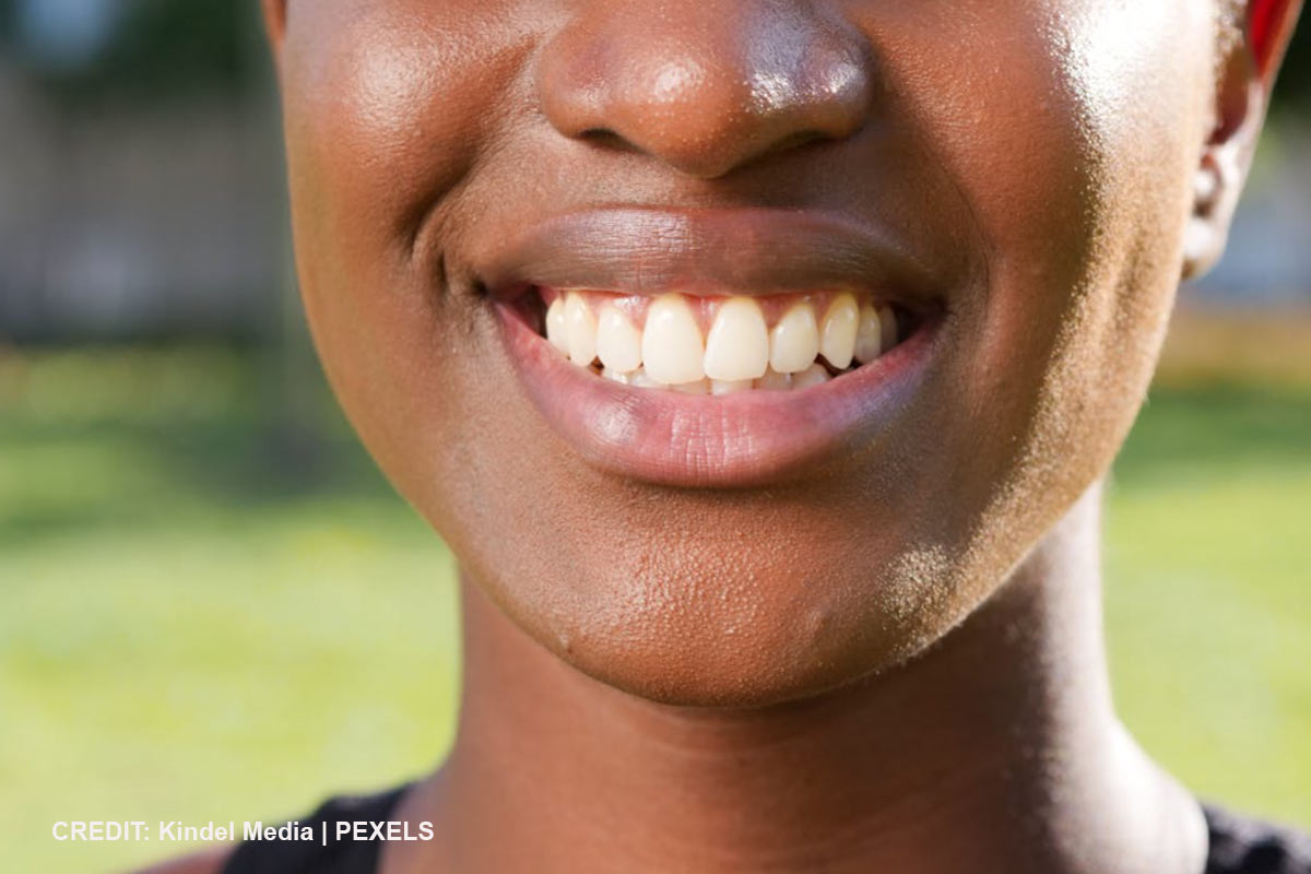 5 Reasons Professional Teeth Cleaning Matters Beyond Just Whiter Teeth