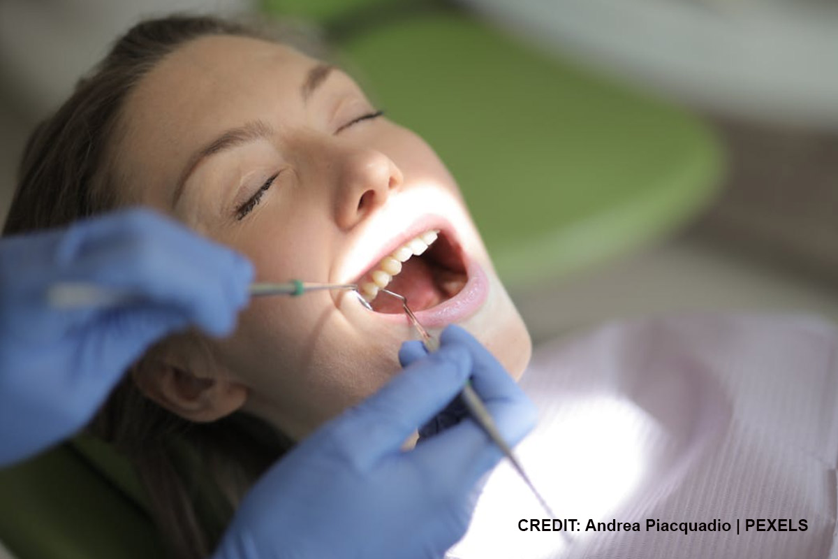 5 Signs That a Professional Teeth Cleaning Is No Longer Optional