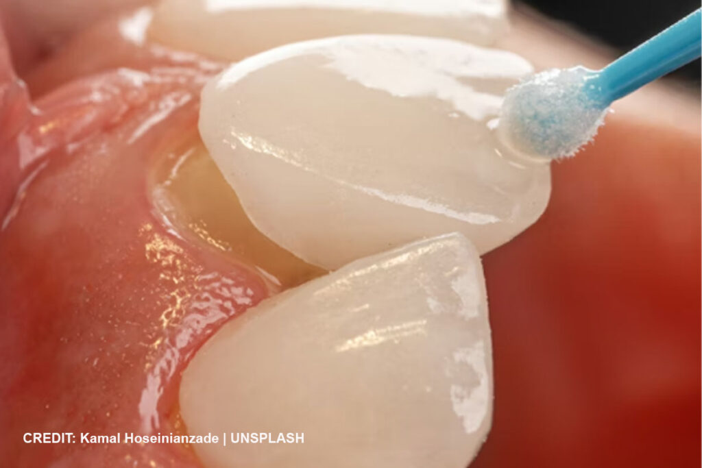 Osseointegration