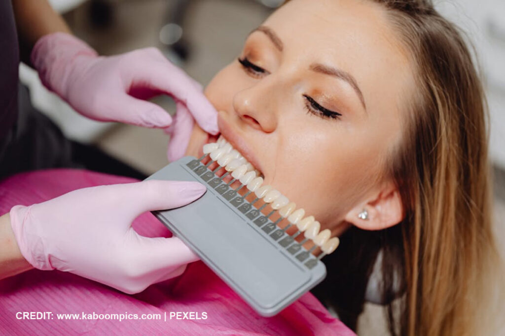 The Trap of DIY Teeth Whitening Kits