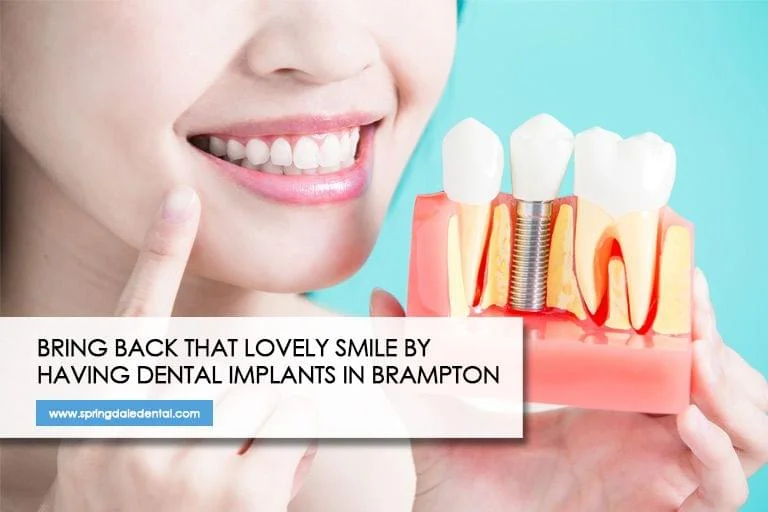 Bring-back-that-lovely-smile-by-having-dental-implants-in-Brampton.jpg.bv_resized_ipad.jpg.bv
