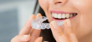 Invisalign