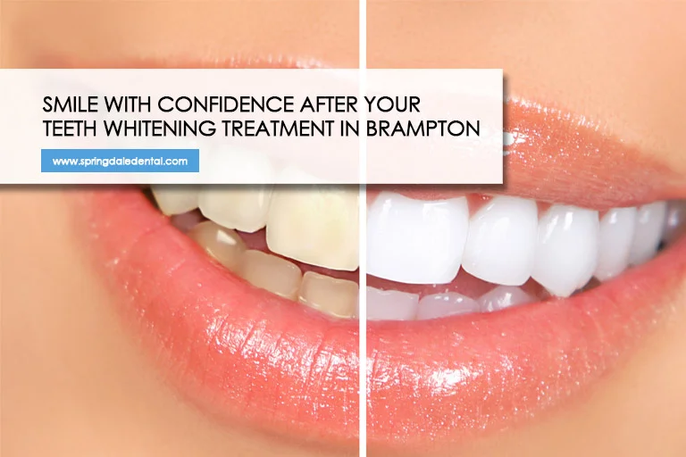 Smile-with-confidence-after-your-teeth-whitening-treatment-in-Brampton.jpg.bv_resized_desktop.jpg.bv