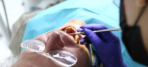 Teeth Cleaning