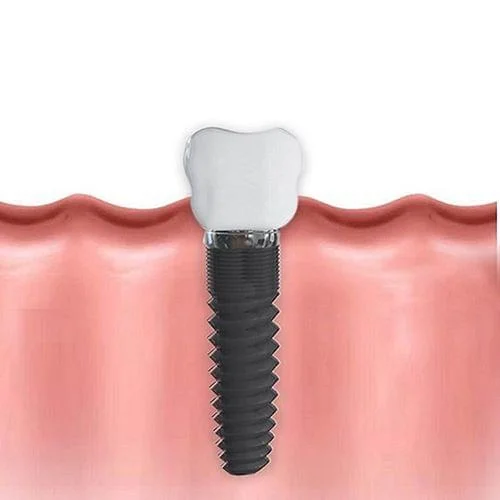 tooth.jpg.bv_resized_ipad.jpg.bv
