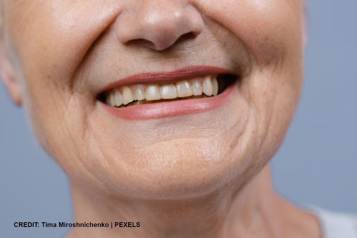 Maintaining Your Restored Smile
