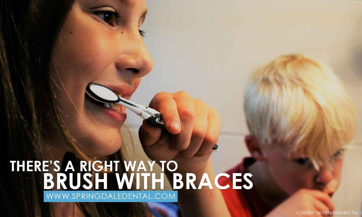 Brushing with Braces Made Easier